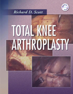 Scott | Total Knee Arthroplasty | Buch | 978-0-7216-3948-2 | sack.de