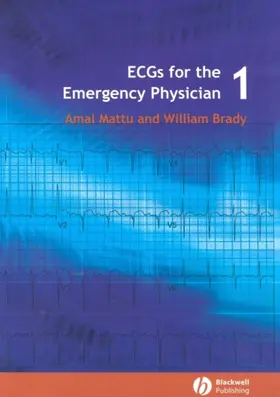 Mattu / Brady |  ECGs for the Emergency Physician 1 | Buch |  Sack Fachmedien