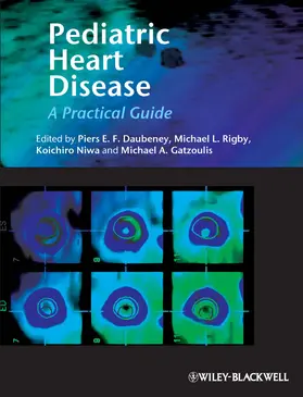 Daubeney / Rigby / Gatzoulis |  Pediatric Heart Disease | Buch |  Sack Fachmedien