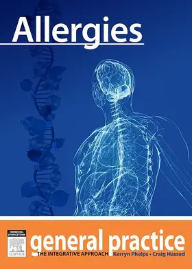 Phelps / Hassed |  Allergies | eBook | Sack Fachmedien