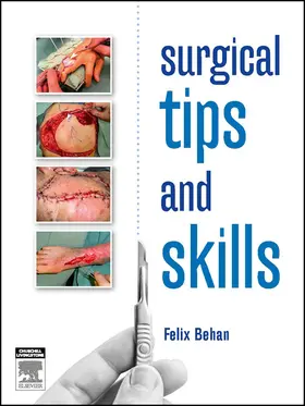 Behan FRCS FRACS / Behan |  Surgical tips and skills - eBook | eBook | Sack Fachmedien