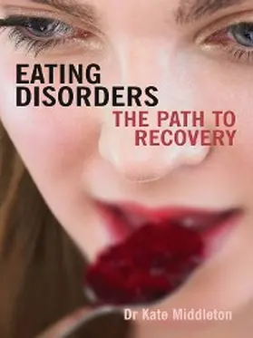 Middleton |  Eating Disorders | eBook | Sack Fachmedien