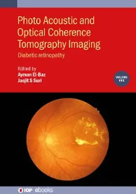 El-Baz / Suri | Photo Acoustic and Optical Coherence Tomography Imaging, Volume 1 | E-Book | sack.de