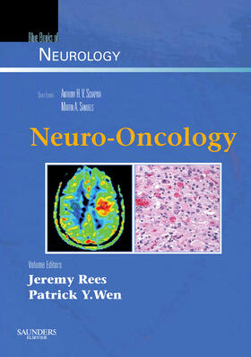 Rees / Wen | Neuro-Oncology | Buch | 978-0-7506-7516-1 | sack.de