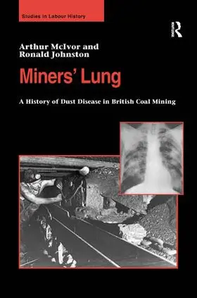 McIvor / Johnston |  Miners' Lung | Buch |  Sack Fachmedien
