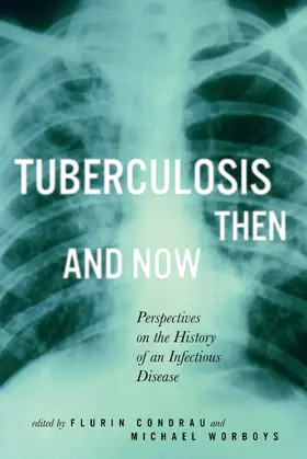 Condrau / Worboys |  Tuberculosis Then and Now | eBook | Sack Fachmedien