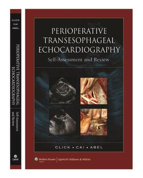 Click / Cai / Abel | Click, R: Perioperative Transesophageal Echocardiography Sel | Buch | 978-0-7817-5576-4 | sack.de