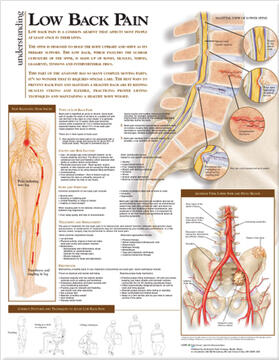 Understanding Low Back Pain Anatomical Chart | Sonstiges | 978-0-7817-8242-5 | sack.de