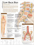  Understanding Low Back Pain Anatomical Chart | Sonstiges |  Sack Fachmedien
