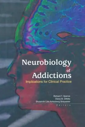 Straussner / Spence / Dinitto | Neurobiology of Addictions | Buch | 978-0-7890-1666-9 | www.sack.de