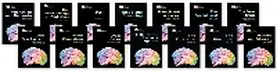  Gray Matter Set | Buch |  Sack Fachmedien