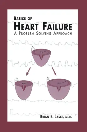 Jaski | Basics of Heart Failure | Buch | 978-0-7923-7786-3 | www.sack.de