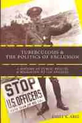 Abel | Tuberculosis and the Politics of Exclusion | Buch | 978-0-8135-4176-1 | sack.de