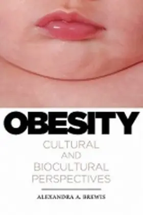 Brewis |  Obesity | Buch |  Sack Fachmedien