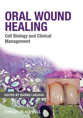 Larjava | Oral Wound Healing | Buch | 978-0-8138-0481-1 | sack.de