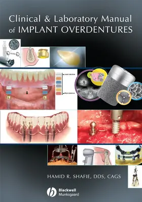 Shafie |  Clinical and Laboratory Manual of Implant Overdentures | Buch |  Sack Fachmedien