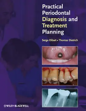 Dibart / Dietrich |  Practical Periodontal Diagnosis and Treatment Planning | eBook | Sack Fachmedien