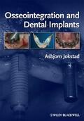 Jokstad |  Osseointegration and Dental Implants | Buch |  Sack Fachmedien