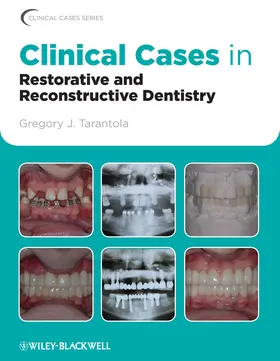 Tarantola | Clinical Cases in Restorative and Reconstructive Dentistry | Buch | 978-0-8138-1564-0 | www.sack.de