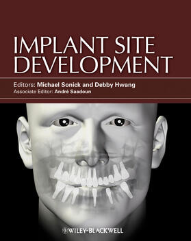 Sonick / Hwang |  Implant Site Development | Buch |  Sack Fachmedien