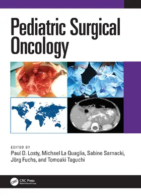 Losty / La Quaglia / Sarnacki |  Pediatric Surgical Oncology | Buch |  Sack Fachmedien