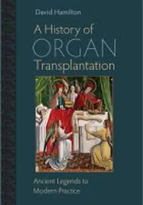 Hamilton |  A History of Organ Transplantation | Buch |  Sack Fachmedien