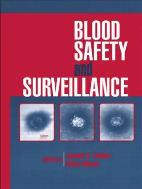 Linden | Blood Safety and Surveillance | Buch | 978-0-8247-0263-2 | www.sack.de