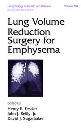 Fessler / Reilly / Sugarbaker |  Lung Volume Reduction Surgery for Emphysema | Buch |  Sack Fachmedien