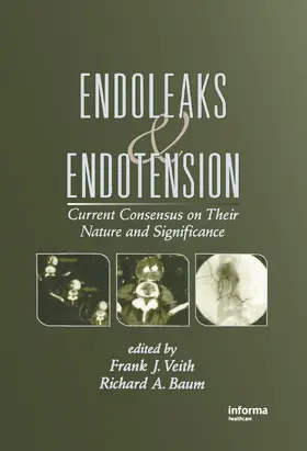 Veith / Baum |  Endoleaks and Endotension | Buch |  Sack Fachmedien