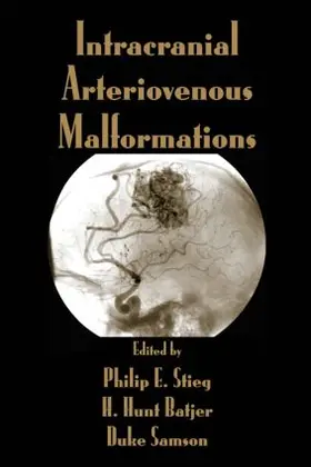 Stieg / Batjer / Samson |  Intracranial Arteriovenous Malformations | Buch |  Sack Fachmedien