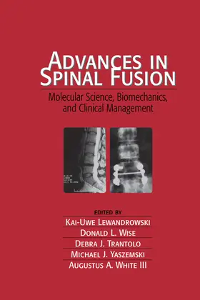 Lewandrowski |  Advances in Spinal Fusion | Buch |  Sack Fachmedien