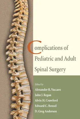 Vaccaro / Regan / Crawford |  Complications of Pediatric and Adult Spinal Surgery | Buch |  Sack Fachmedien