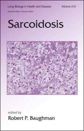 Baughman |  Sarcoidosis | Buch |  Sack Fachmedien