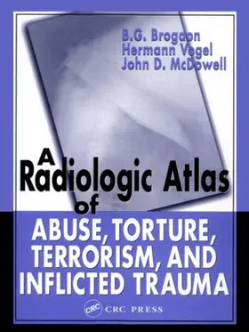 Brogdon / Vogel / McDowell | A Radiologic Atlas of Abuse, Torture, Terrorism, and Inflicted Trauma | Buch | 978-0-8493-1533-6 | www.sack.de