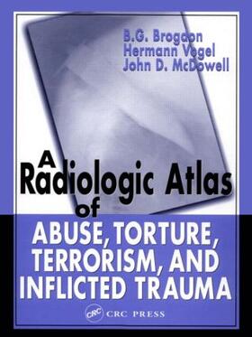 Brogdon / Vogel / McDowell | A Radiologic Atlas of Abuse, Torture, Terrorism, and Inflicted Trauma | Buch | 978-0-8493-1533-6 | sack.de