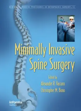 Vaccaro / Bono |  Minimally Invasive Spine Surgery | Buch |  Sack Fachmedien