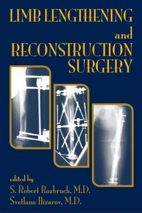 Rozbruch / Ilizarov |  Limb Lengthening and Reconstruction Surgery | Buch |  Sack Fachmedien