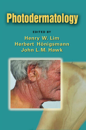 Lim / Hawk / Honigsmann | Photodermatology | Buch | 978-0-8493-7496-8 | sack.de