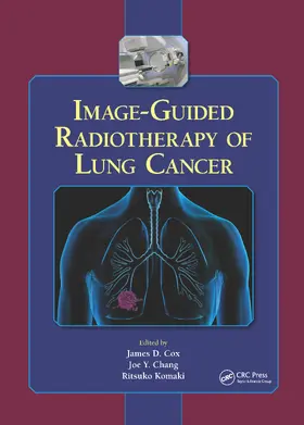 Cox / Chang / Komaki |  Image-Guided Radiotherapy of Lung Cancer | Buch |  Sack Fachmedien