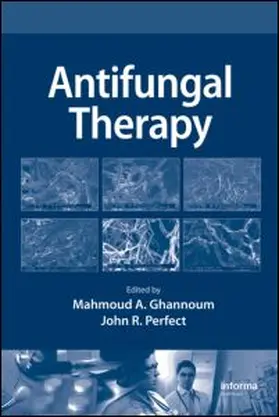 Antifungal Therapy | Buch | 978-0-8493-8787-6 | www.sack.de