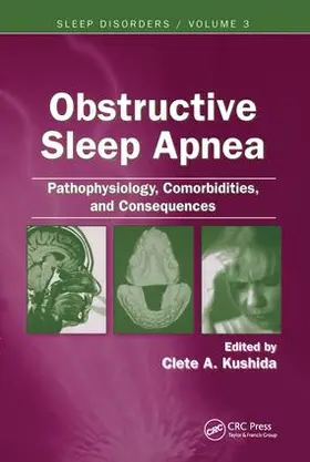 Kushida | Obstructive Sleep Apnea: Pathophysiology, Comorbidities and Consequences | Buch | 978-0-8493-9180-4 | www.sack.de