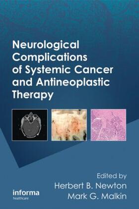 Newton / Malkin | Neurological Complications of Systemic Cancer and Antineoplastic Therapy | Buch | 978-0-8493-9191-0 | sack.de