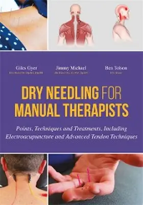 Gyer / Michael / Tolson |  Dry Needling for Manual Therapists | eBook | Sack Fachmedien