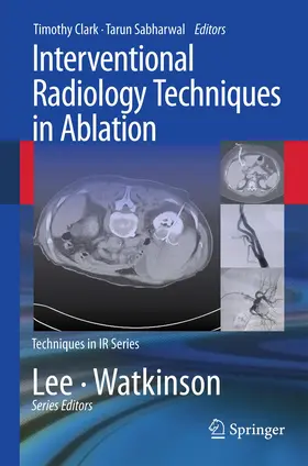 Sabharwal / Clark |  Interventional Radiology Techniques in Ablation | Buch |  Sack Fachmedien