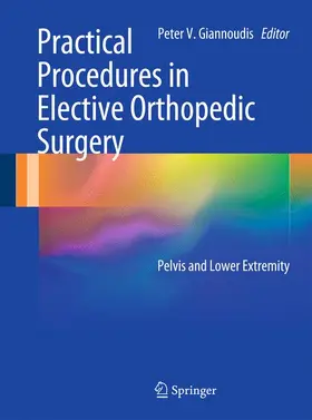 Giannoudis |  Practical Procedures in Elective Orthopaedic Surgery | Buch |  Sack Fachmedien