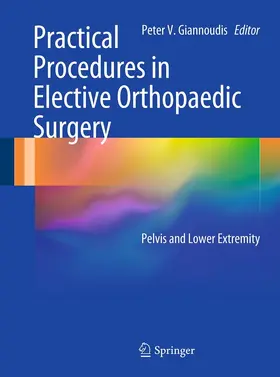 Giannoudis |  Practical Procedures in Elective Orthopaedic Surgery | eBook | Sack Fachmedien