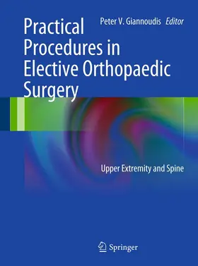Giannoudis |  Practical Procedures in Elective Orthopedic Surgery | eBook | Sack Fachmedien