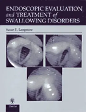 Langmore |  Endoscopic Evaluation and Treatment of Swallowing Disorders | Buch |  Sack Fachmedien