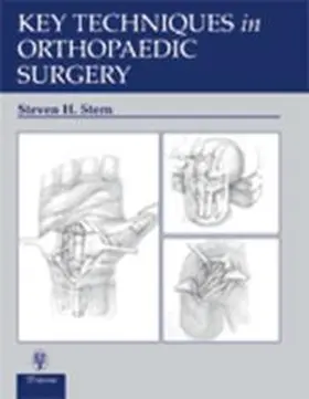 Stern | Key Techniques in Orthopaedic Surgery | Buch | 978-0-86577-922-8 | www.sack.de