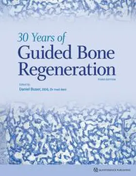 Buser | 30 Years of Guided Bone Regeneration | Buch | 978-0-86715-803-8 | sack.de